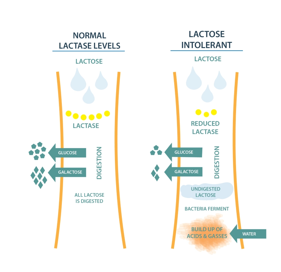 Lactose Intolerance Diagram A Genetic Test For Lactose Intolerance